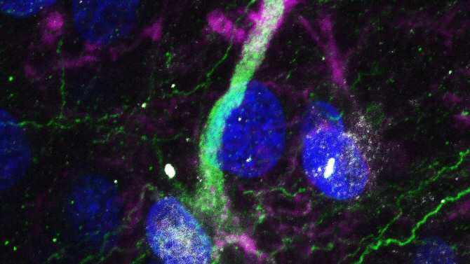 2463 celulas madre en el cerebro humano
