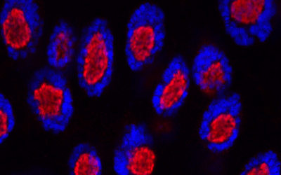 Descubren una nueva función clave de unas proteínas implicadas en enfermedades humanas y en el desarrollo embrionario