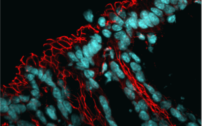 Descubren un mecanismo celular que altera la microbiota intestinal y aumenta la aparición de enfermedades múltiples
