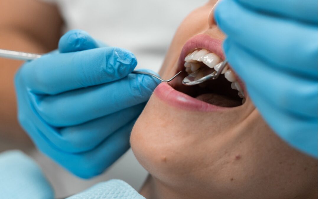 Las bacterias de las encías anticipan el riesgo de padecer periodontitis
