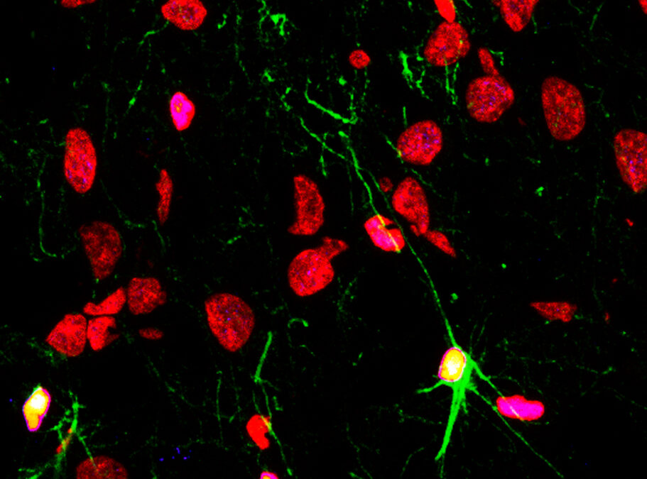 Las enfermedades psiquiátricas y el consumo de alcohol y drogas limitan la capacidad del cerebro para generar nuevas neuronas