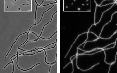 Un hallazgo abre la puerta a frenar la división de bacterias peligrosas