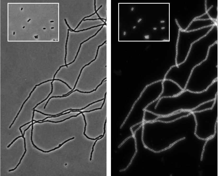 Un hallazgo abre la puerta a frenar la división de bacterias peligrosas