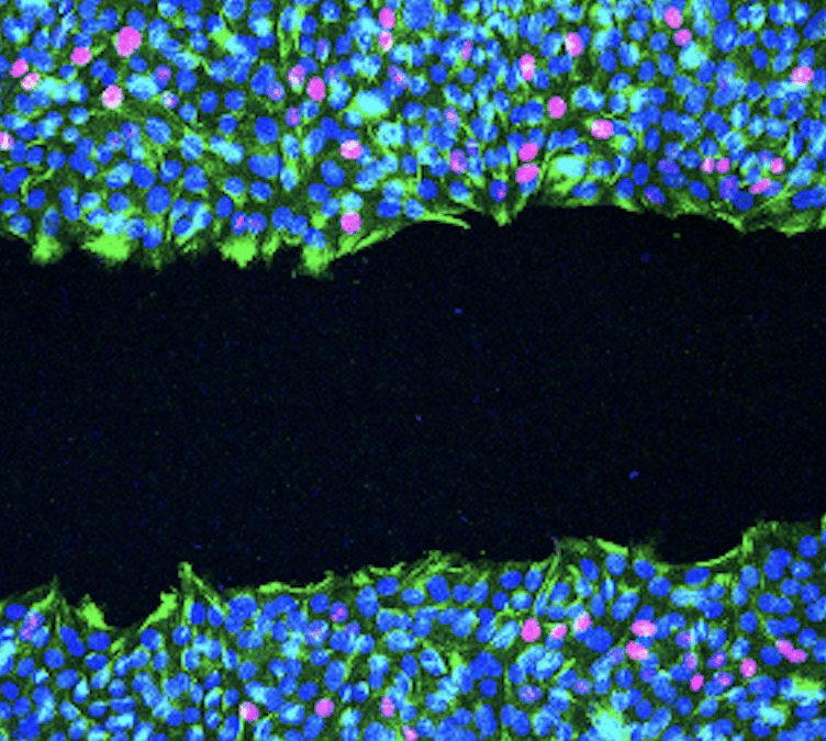 Nuevo estudio revela cómo mutaciones específicas en BRCA2 alteran procesos clave en el cáncer