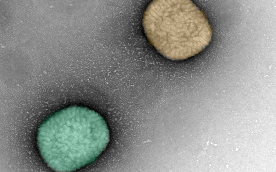 Una variante reciente del virus mpox es más virulenta que la del brote global de 2022