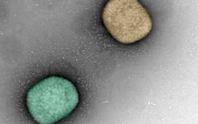 Una variante reciente del virus mpox es más virulenta que la del brote global de 2022