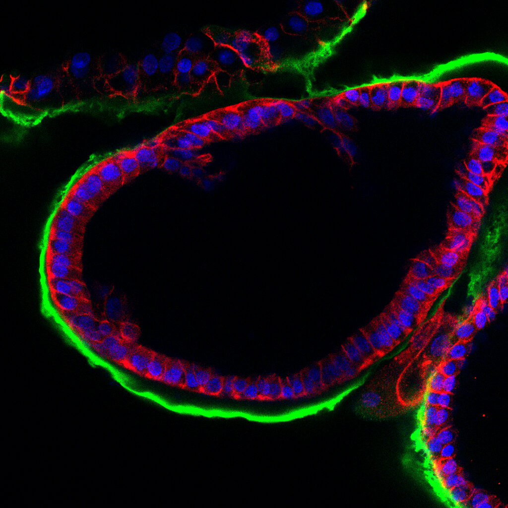 ImageJ=1.54funit=micron