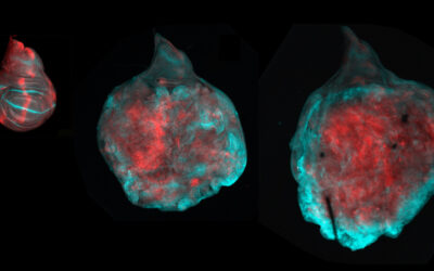 La mosca del vinagre ayuda a entender las múltiples caras de una proteína supresora de tumores