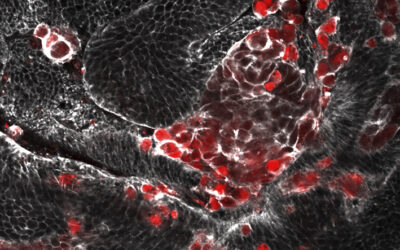 El «efecto contagio» de las células que envejecen abre nuevas vías para entender el origen de los tumores