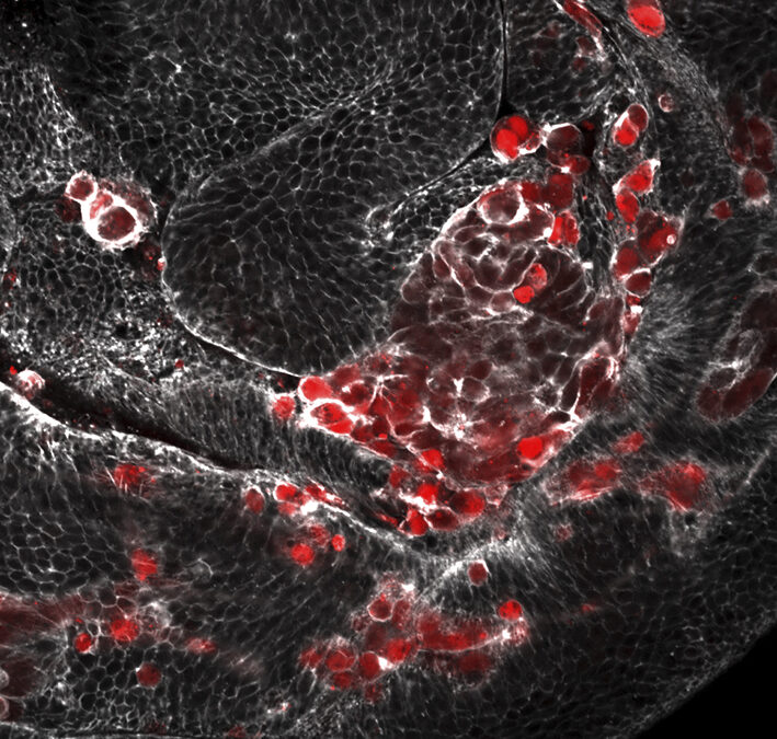 El «efecto contagio» de las células que envejecen abre nuevas vías para entender el origen de los tumores
