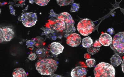 Identifican un nuevo mecanismo por el que el entorno tumoral favorece la progresión del cáncer oral