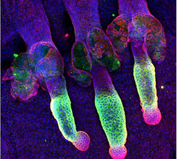Identifican un proceso clave que protege al folículo piloso de la pérdida de pelo