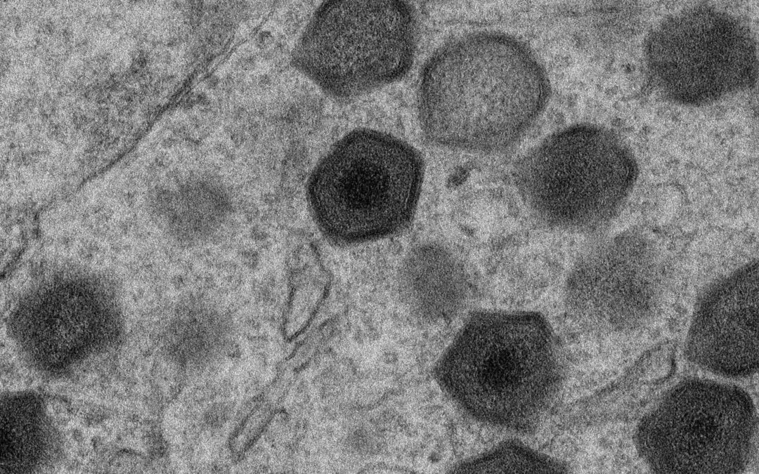 Logran reducir la virulencia y mejorar la protección frente al virus de la peste porcina africana