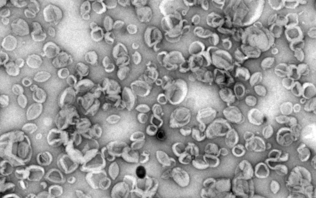 Desarrollan nanovehículos sintéticos que potencian la respuesta inmunitaria y abrirían el camino a vacunas más eficaces