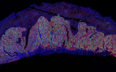 Un estudio revela el papel clave de una proteína en la formación de la placenta y el crecimiento del feto