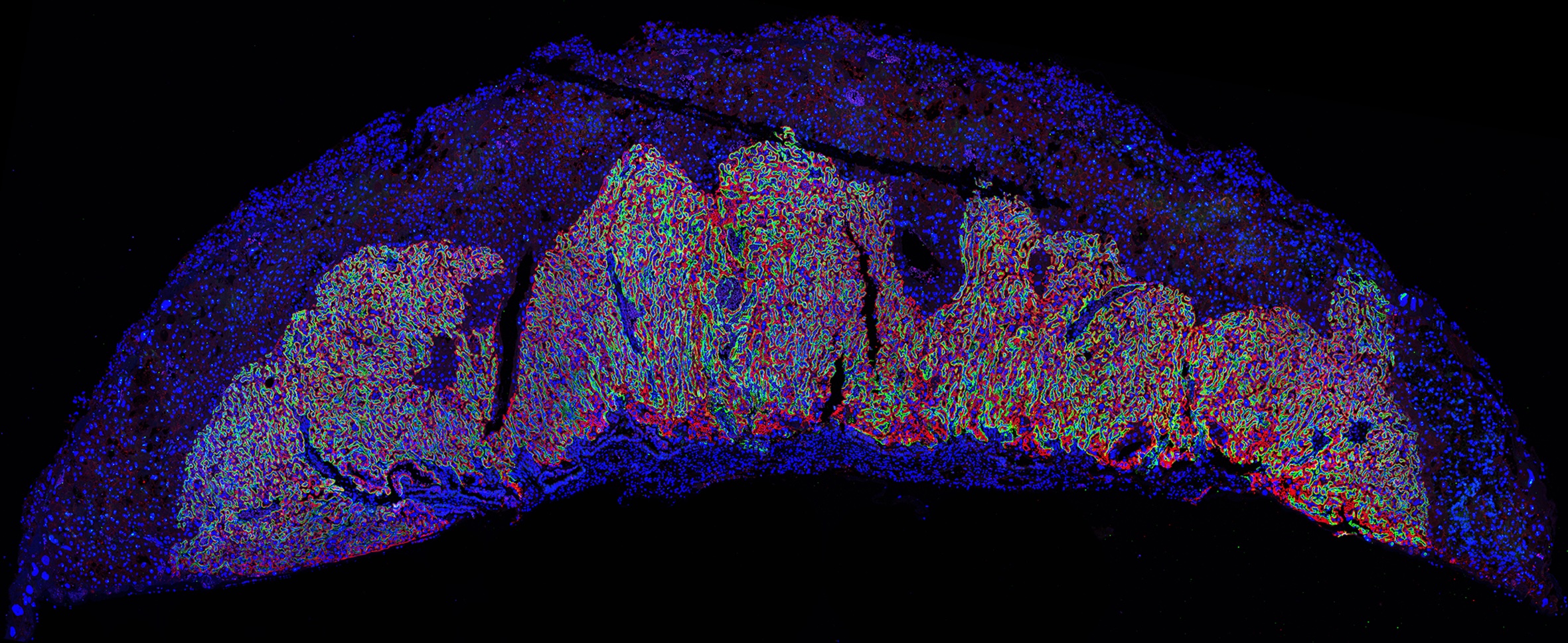 ImageJ=1.54punit=micron