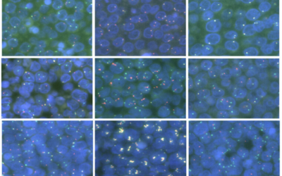 Un nuevo mapa de 29 modelos de linfoma permite afinar la investigación del cáncer