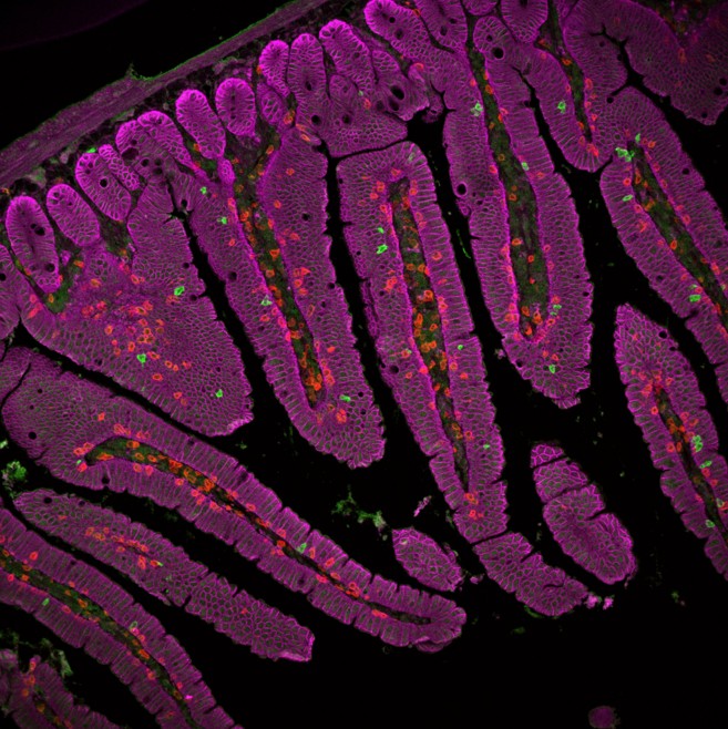 Célula Tgd en verde patrullando el intestino